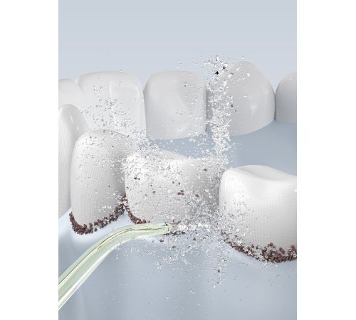 Ирригатор  Oclean W10 розовый